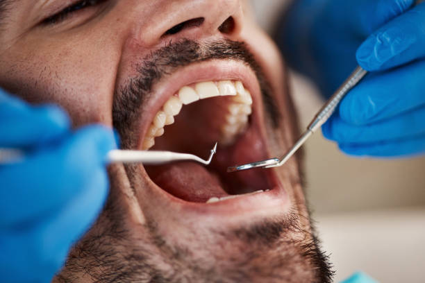 Best Broken or Cracked Tooth Emergency Dentist in Atco, NJ